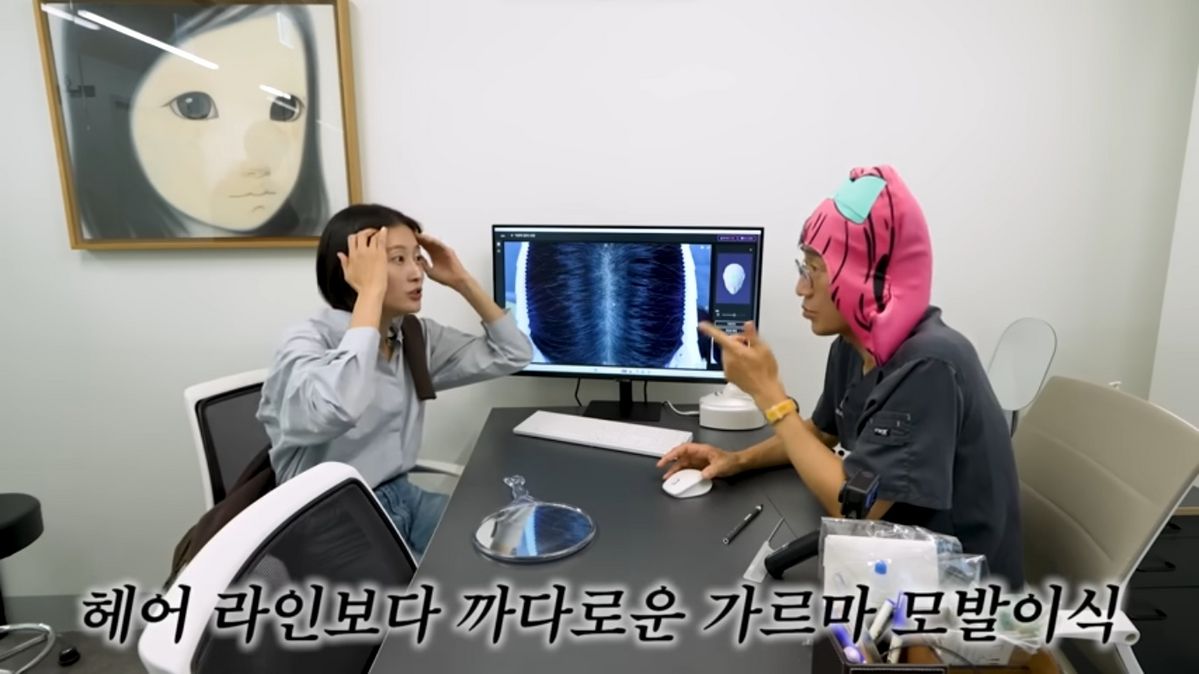 이현이 모발 이식 | 출처 유튜브 <워킹맘 이현이>