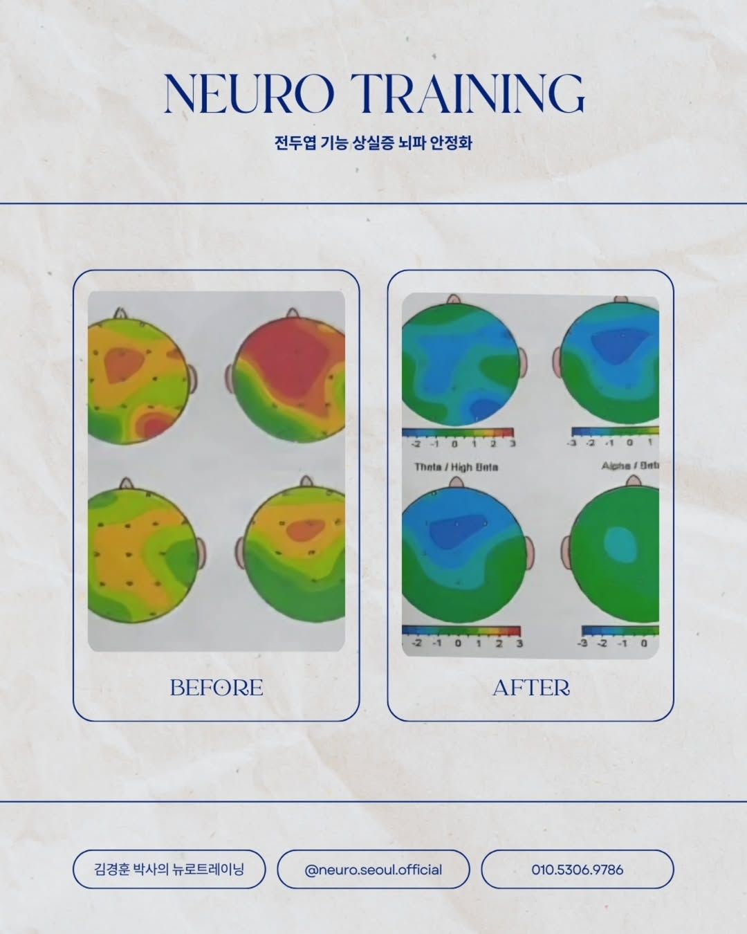 뉴로 트레이닝 | 인스타그램 @neuro.seoul.official