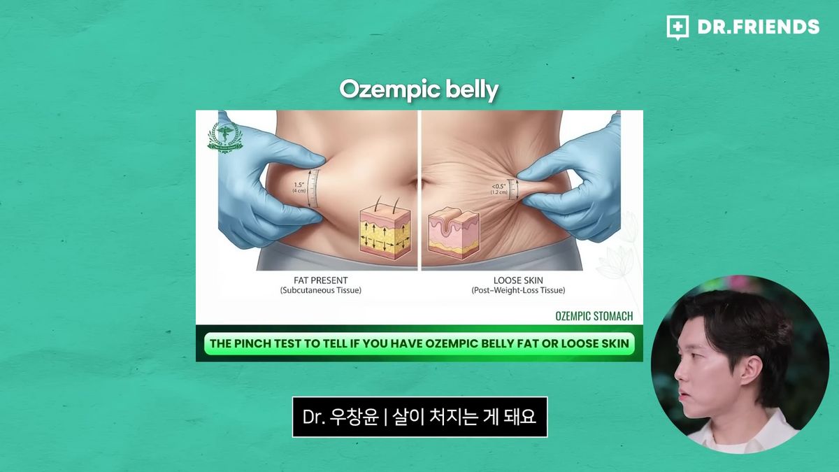 숫자만 줄이려는 다이어트는 피부 탄력을 떨어뜨리며, 결과적으로는 라인이 망가질 수 있다. 유튜브 ‘닥터 프렌즈’